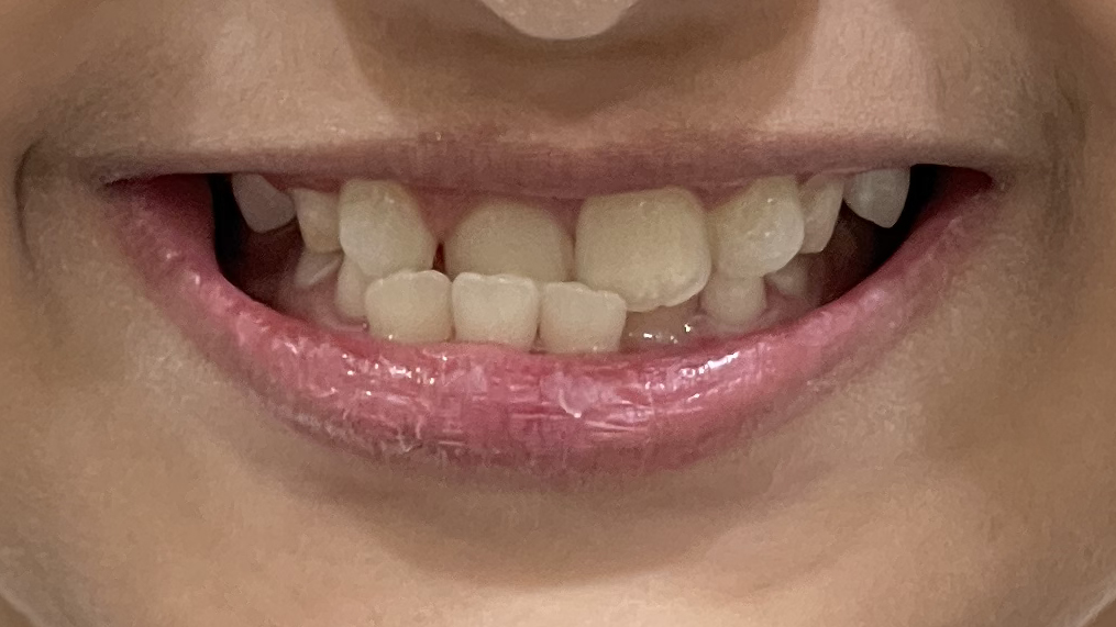 Best Orthodontist In Jumeirah, Dubai 17 10A