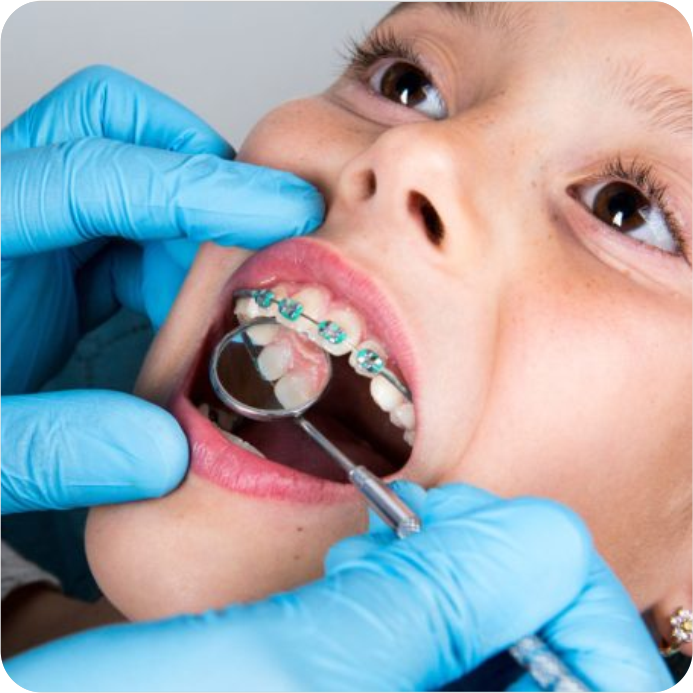 Orthodontic Screenings