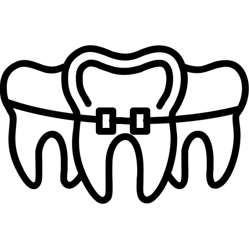 Sliding Mechanism