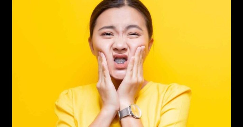 Orthodontic headgear Jumeirah