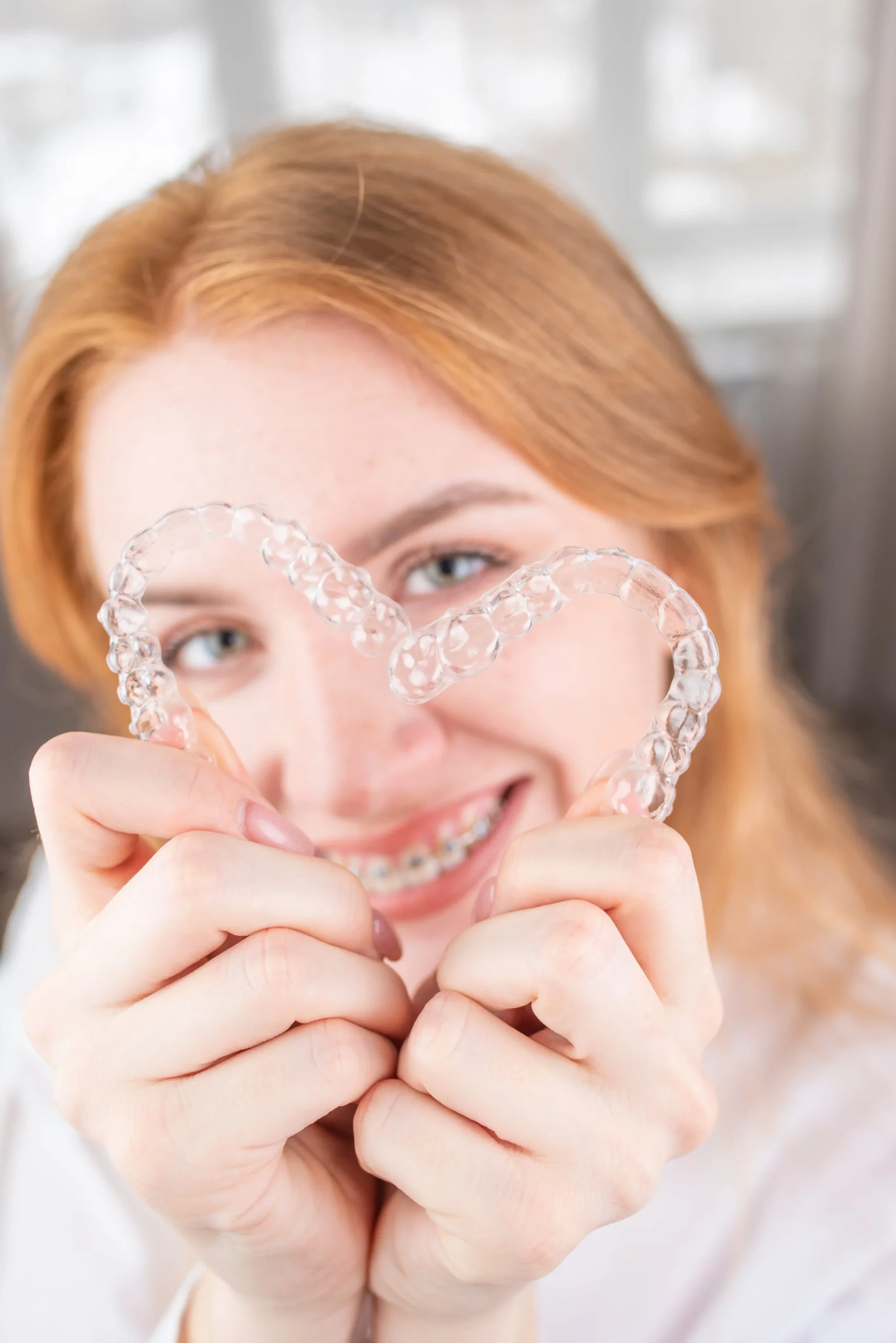 Services 6 Permanent Dental Retainer