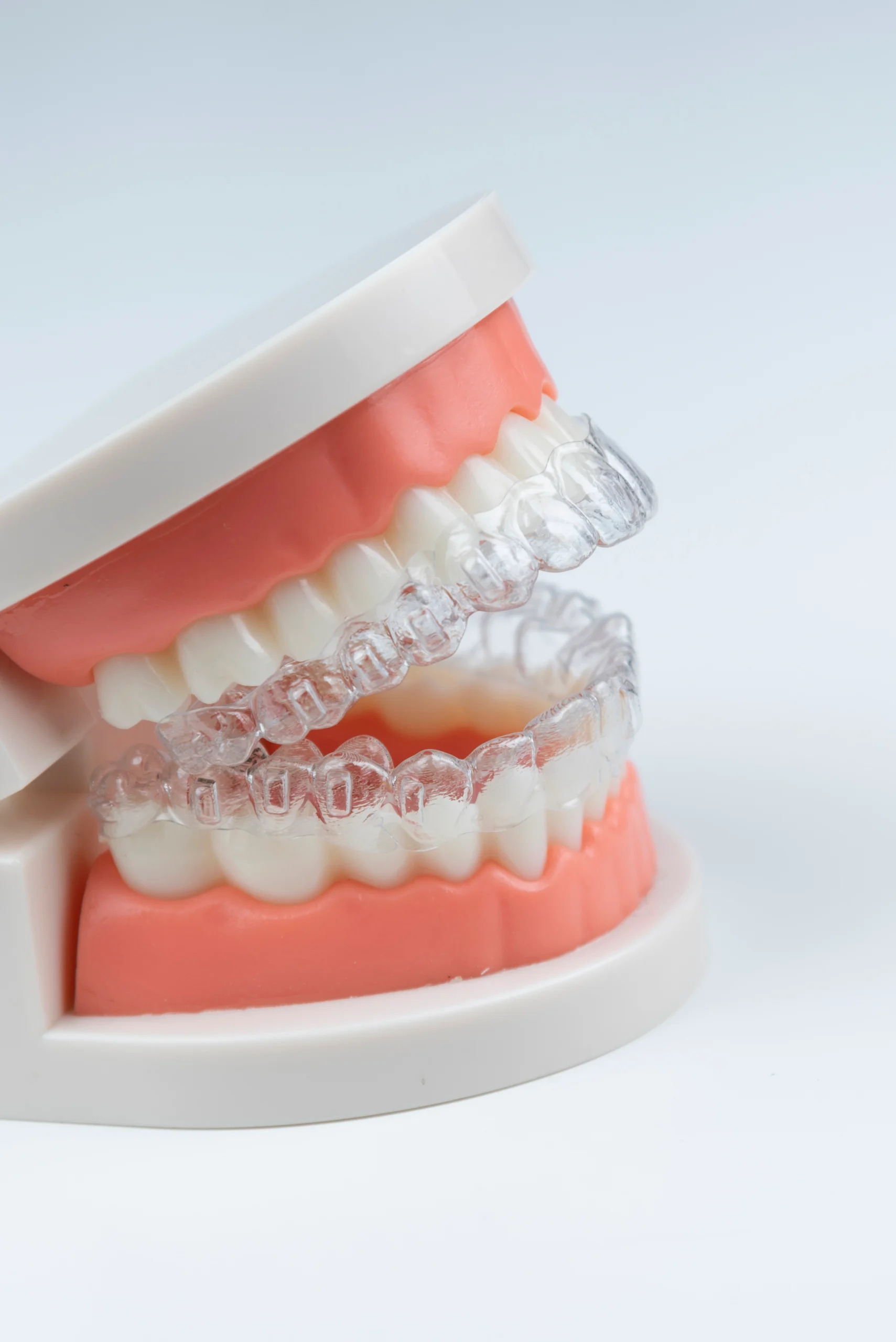 invisible removable aligners teeth alignment