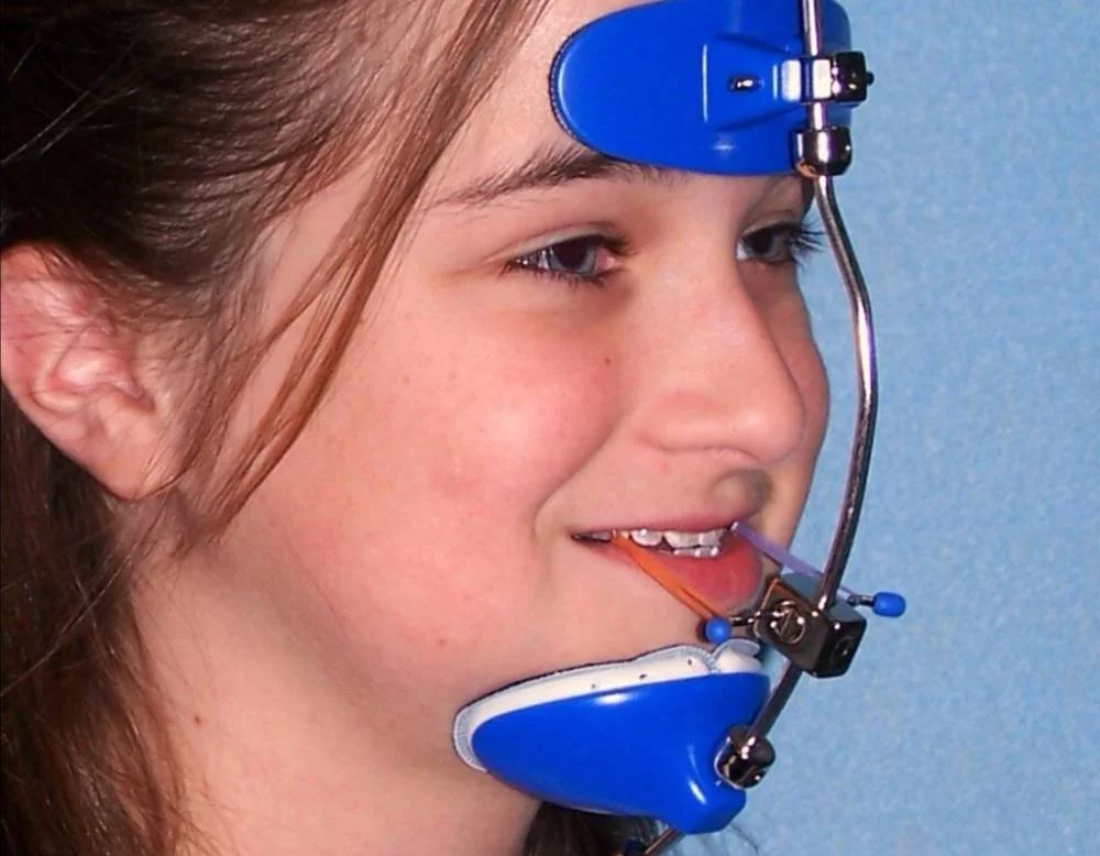 orthodontic headgear