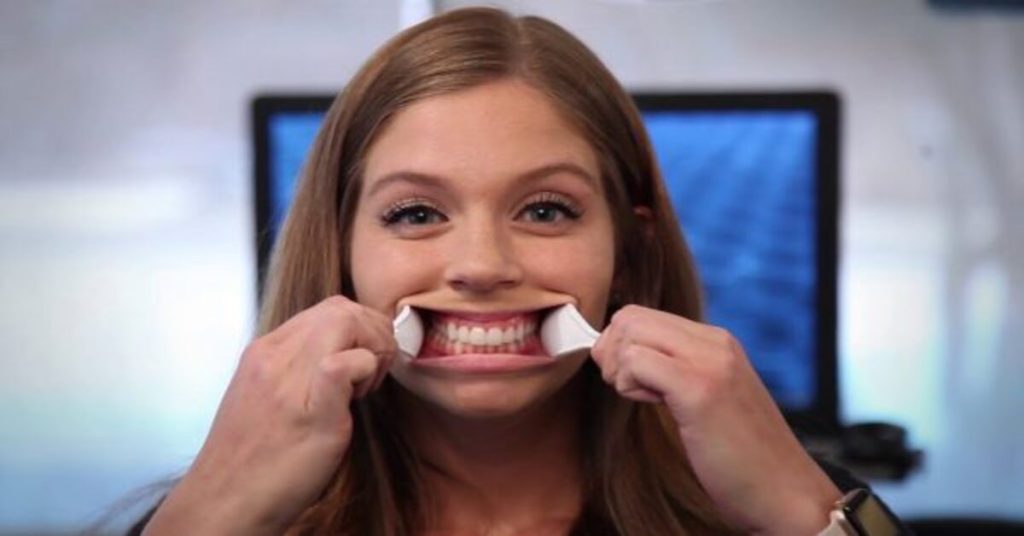 Online Braces Consultation