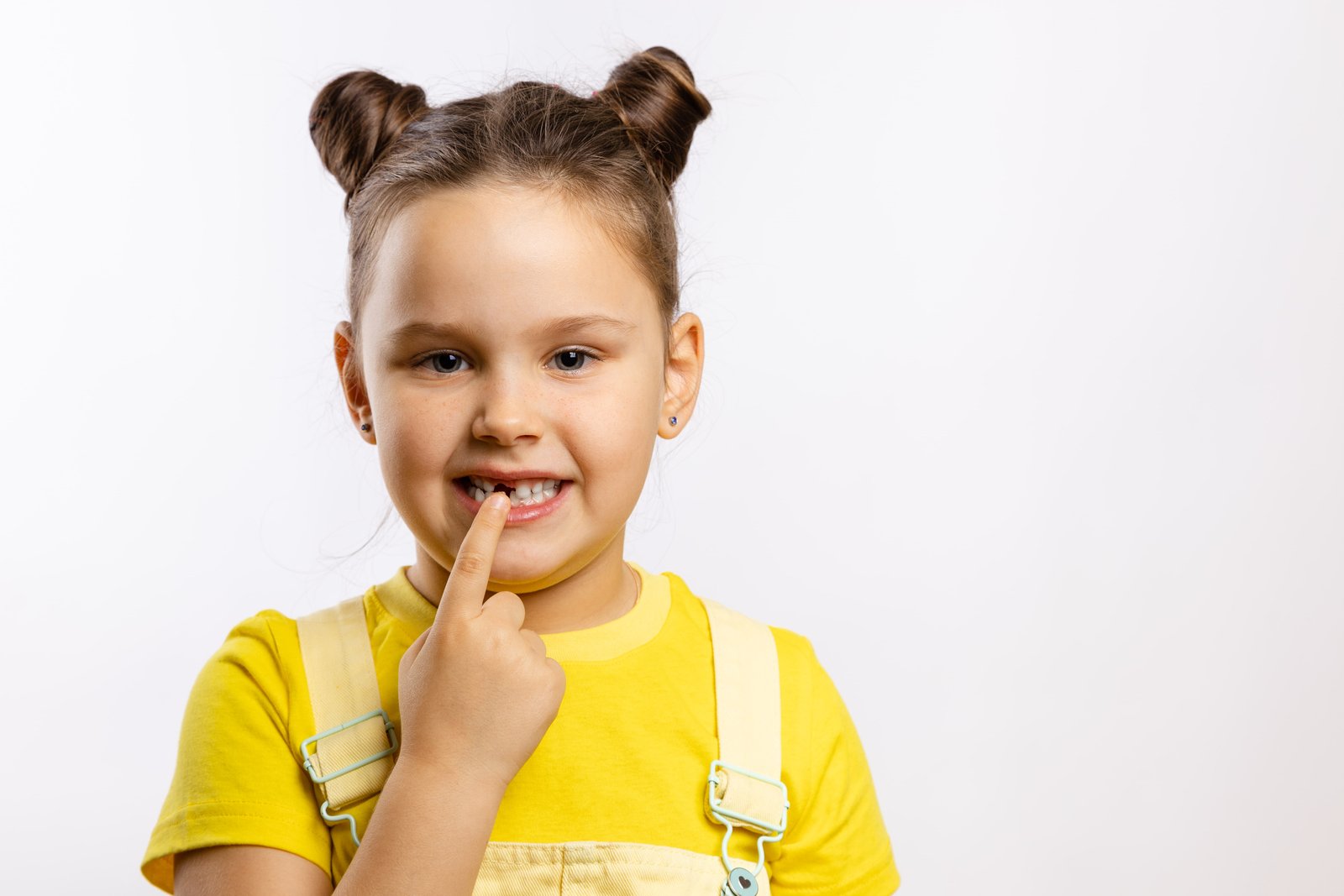 Why Treating Kids Early Can Make a Big Difference 1 early-orthodontic-treatment