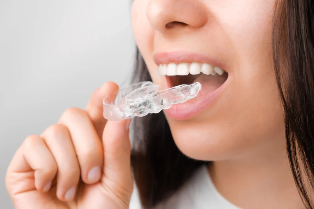 Clear Aligner Treatment Is For Everyone: Science-backed Smiles For All Ages 1 Clear Aligner Treatment