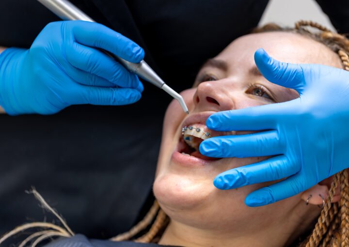 Can Orthodontic Treatment Improve Your Facial Profile in Dubai? 1 Orthodontic Treatment