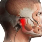 malocclusion and TMJ connection.