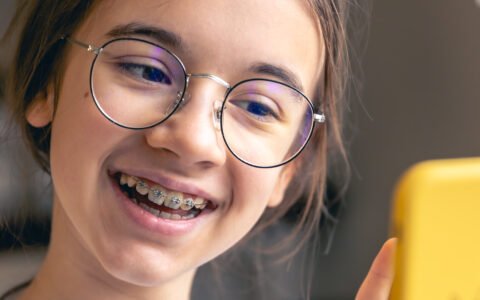 Orthodontic Expanders at AQR Orthodontics Jumeirah, Dubai 3 Orthodontist Expanders