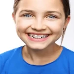 Benefits of Functional Orthodontics