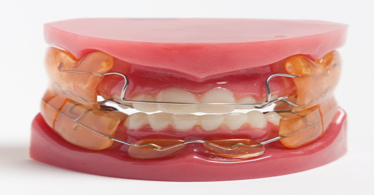 Functional Orthodontics Appliances