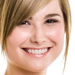 Damon Braces Explained