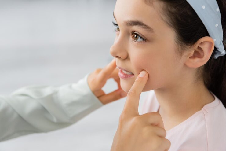 mouth breathing treatment