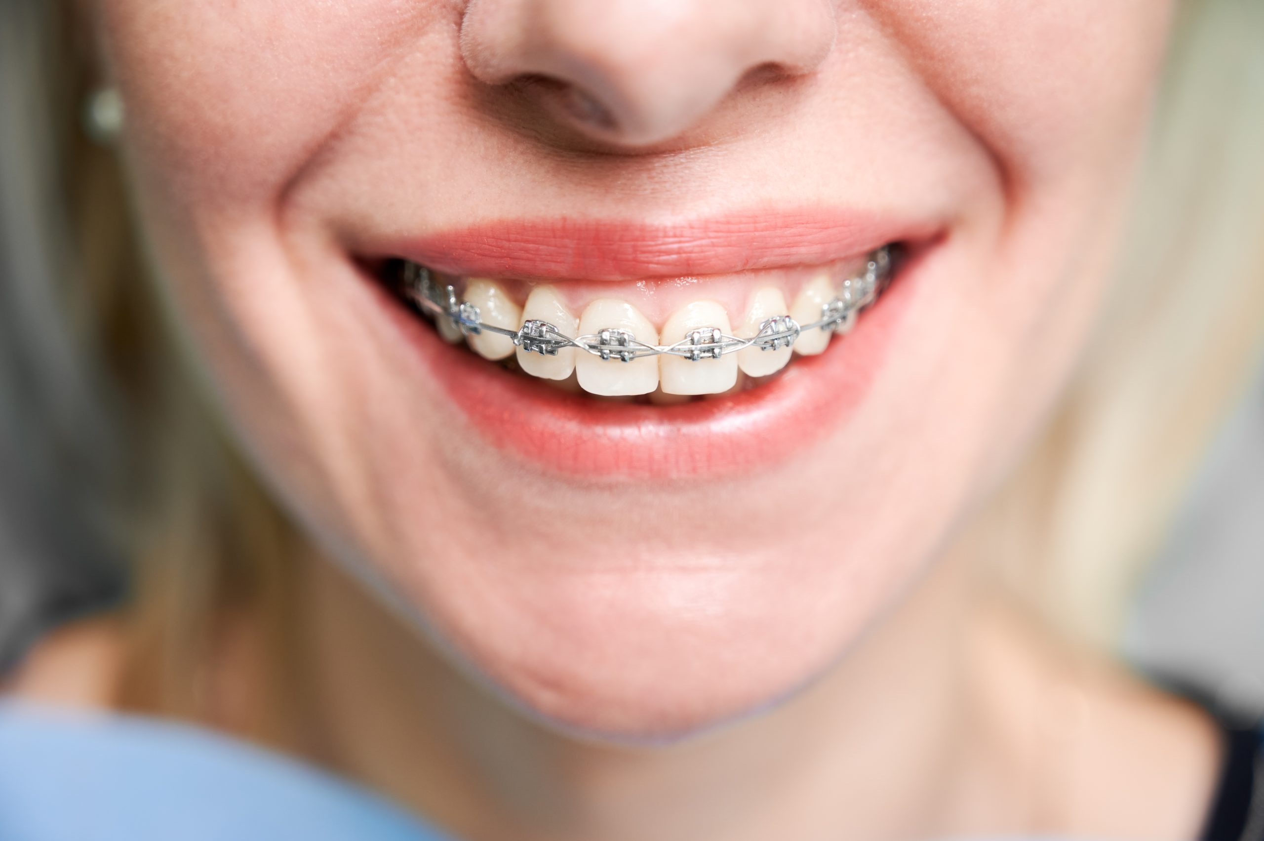 How long does Orthodontic treatment takes?